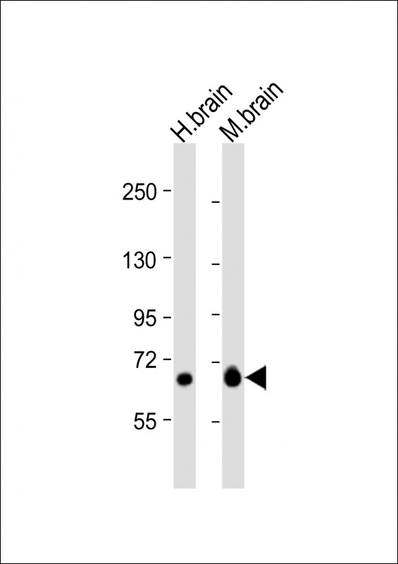 WB - GLS Antibody (N-Term) AP21776a